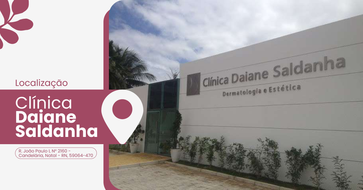 Localização